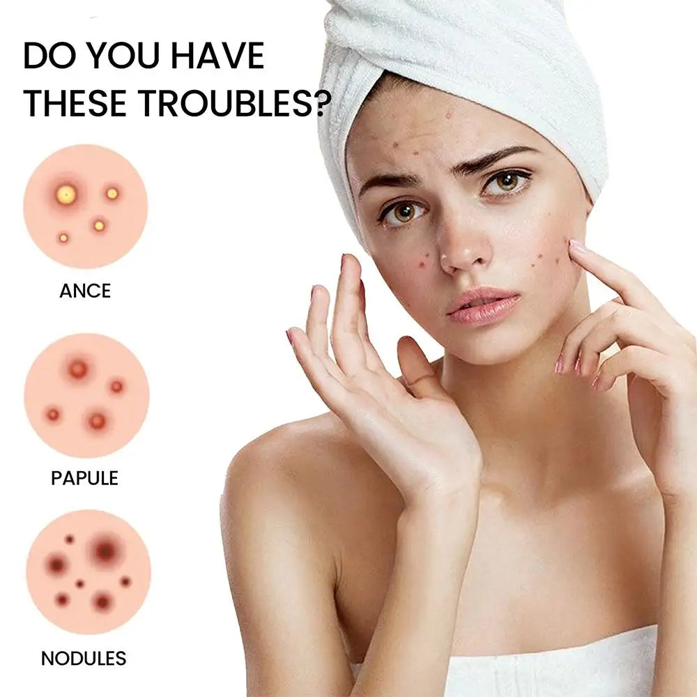 Babe's Acne Patches