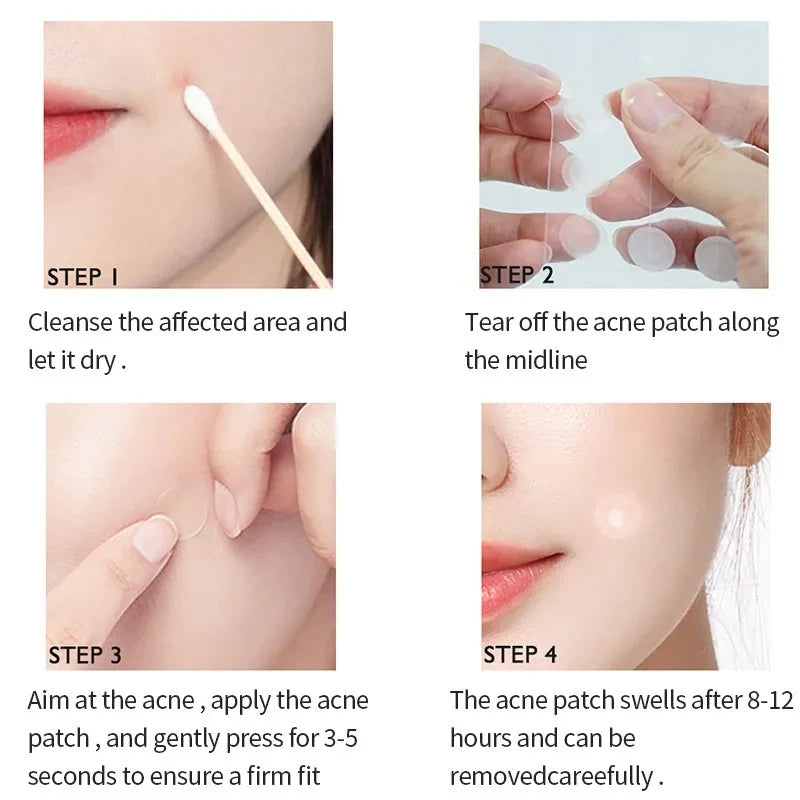 Babe's Invisible Acne Patches