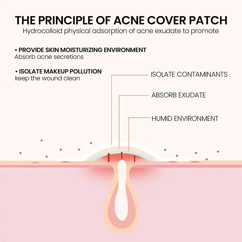 Babe's Acne Patches